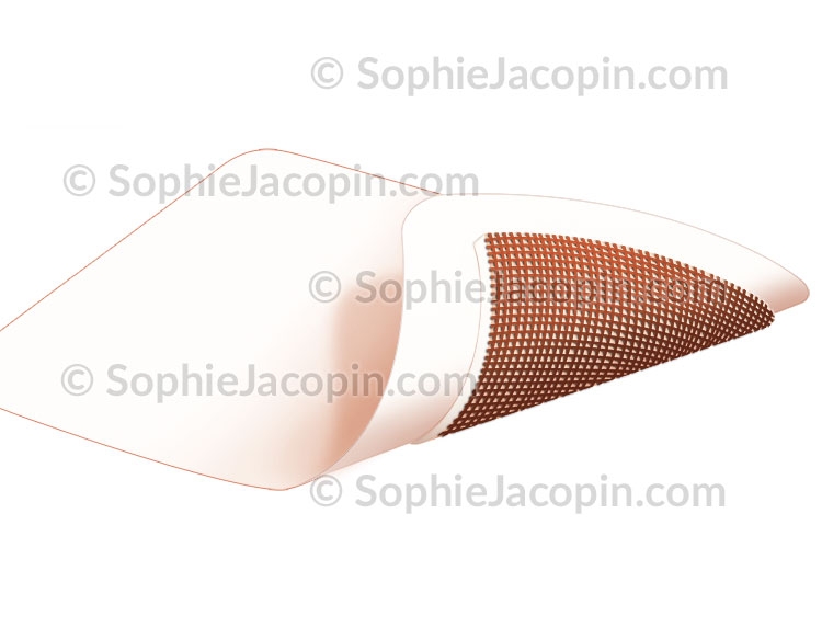 Didactique Scientifique Pansement cicatrisant