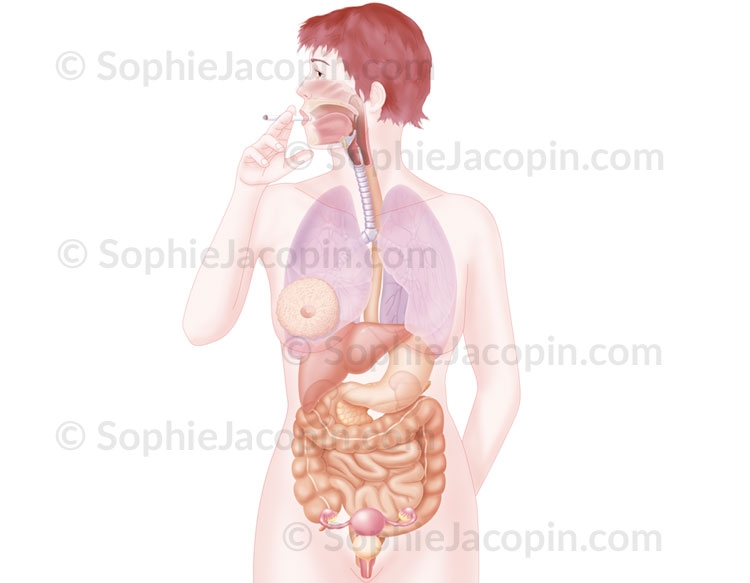 Illustration medicale - Anatomie Physiologie-Organes atteints cancer fumeur