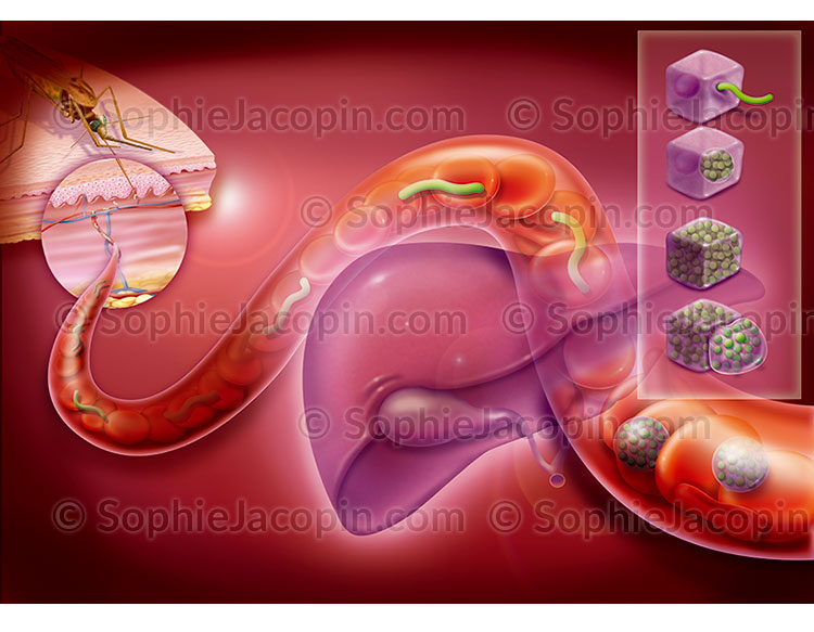 Illustration medicale_Transmission paludisme