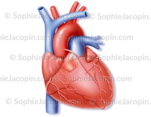 Pontage coronarien, greffe d'un vaisseau qui rejoint l'aorte à l'artère coronaire atteinte afin de dériver la circulation coronarienne © sophie jacopin