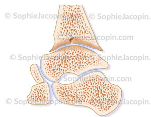 Arthropathie hémophilique de la cheville sur une coupe sagittale médiane - © sophie jacopin