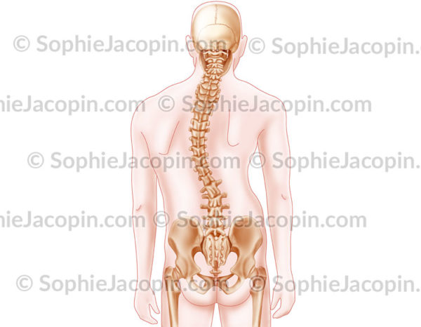 Scoliose, déformation de la colonne vertébrale - © sophie jacopin