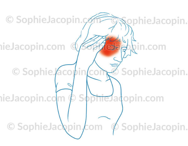 Migraine ophtalmique, maux de tête, céphalées - © sophie jacopin