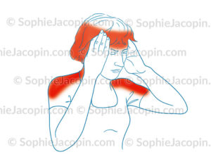 Migraine, maux de tête, céphalées - © sophie jacopin