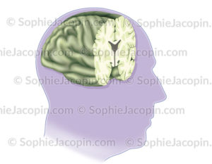 Coupe frontale du cerveau remis en vue de 3/4 dans un visage d'homme âgé - © sophie jacopin