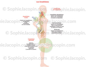 Anesthésies, différents types d'anesthésies - © sophie jacopin