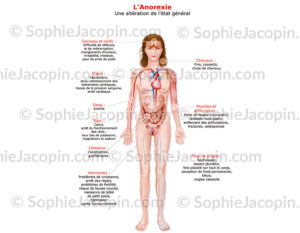 Anorexie, trouble de l'alimentation - © sophie jacopin