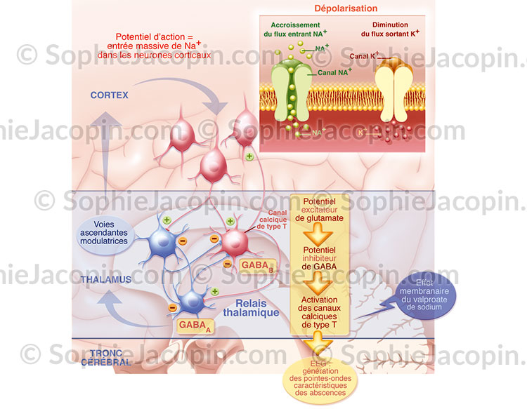 Crise d'épilepsie - Illustration Medicale-© Sophie Jacopin