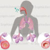 Illustration-medicale-Asthme