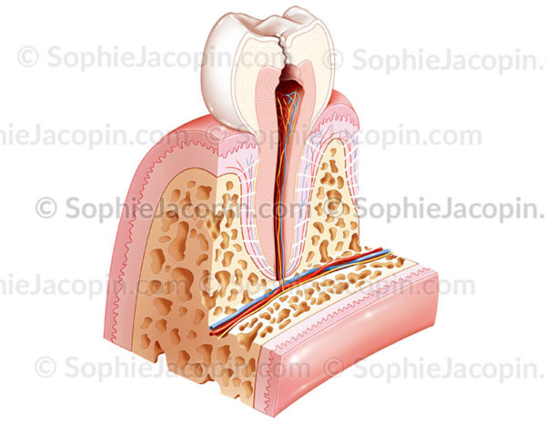 pathologie dentaire carie pulpe - © sophie ajcopin