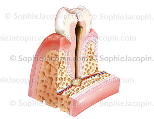 pathologies bucco-dentaire - © sophie jacopin