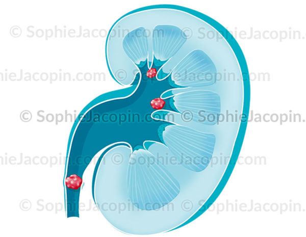 CALCUL R NAL Illustration M dicale Sophie Jacopin