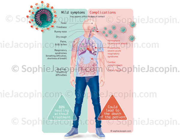 COVID-19, les symptômes provoqués par le coronavirus, SARS-COV-2 (Version anglaise) - © sophie jacopin