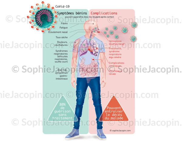 COVID-19, les symptômes et complications provoqués par le coronavirus, SARS-COV-2 - © sophie jacopin