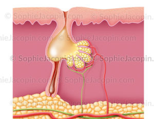 Acné, formation d'un bouton d'acné, physiopathologie, dermatologie - © sophie jacopin