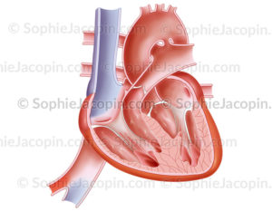 Anatomie du cœur du fœtus, foramen ovale, canal veineux d’Arantius. - © sophie jacopin