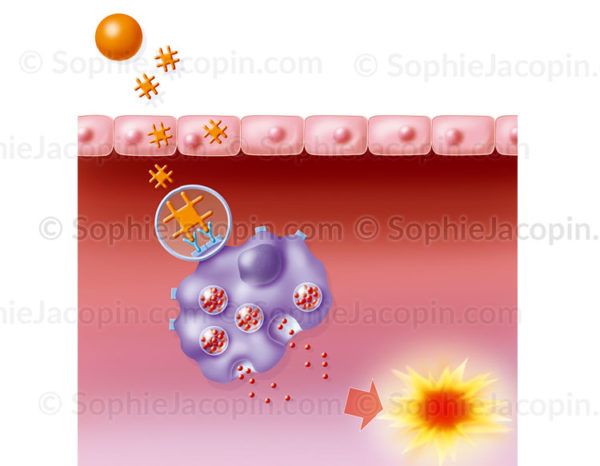 Réaction allergique à la présence d'un allergène : le pollen - © sophie jacopin
