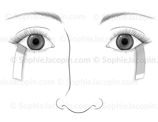 Test de Schirmer, examen ophtalmologique de mesure de quantité de larmes - © sophie jacopin