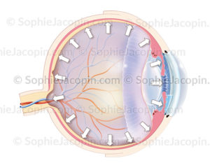 Glaucome, une pathologie de l'œil due à une pression oculaire comprimant le nerf optique - © sophie jacopin
