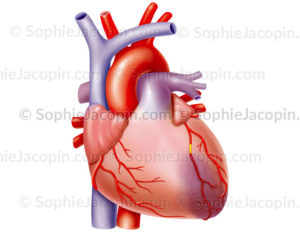 Crise cardiaque ou infarctus du myocarde, nécrose du muscle cardiaque dû à une artère bouchée - © sophie jacopin