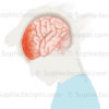 Traumatisme crânien chez l’enfant sur la partie antérieure du cerveau suite à un choc à l’avant de la tête, ecchymoses, œdème - © sophie jacopin