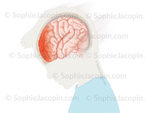 Traumatisme crânien chez l’enfant sur la partie antérieure du cerveau suite à un choc à l’avant de la tête, ecchymoses, œdème - © sophie jacopin