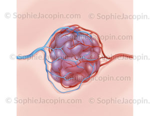 L’angiome caverneux ou cavernome est une malformation vasculaire cérébrale ressemblant à une mûre - © sophie jacopin