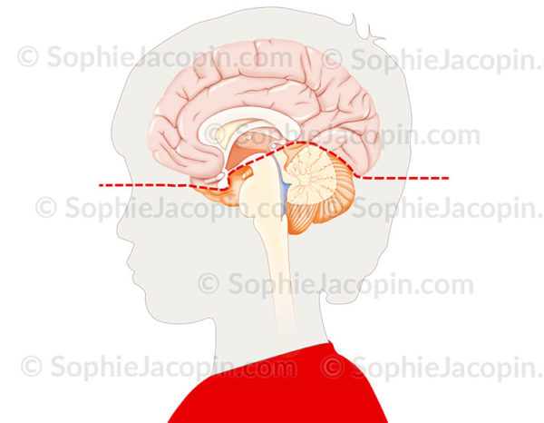 Étage sus et sous-tensoriel, division du cerveau en deux étages par la tente du cervelet - © sophie jacopin