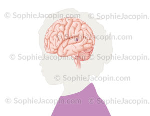 Malformation vasculaire cérébrale, cavernome ou angiome caverneux ressemble à une mûre - © sophie jacopin