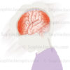 Traumatismes crâniens chez l’enfant sur la partie antérieure et postérieure du cerveau suite à des choc sur tête, ecchymoses, œdème - © sophie jacopin