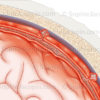 Méningite, détail au niveau de l’inflammation des couches de l’enveloppe de protection du cerveau, les méninges - © sophie jacopin