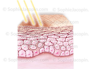 Bronzage de la peau sous l'effet des rayons ultraviolets du soleil grâce aux mélanocytes et la mélanine - © sophie jacopin